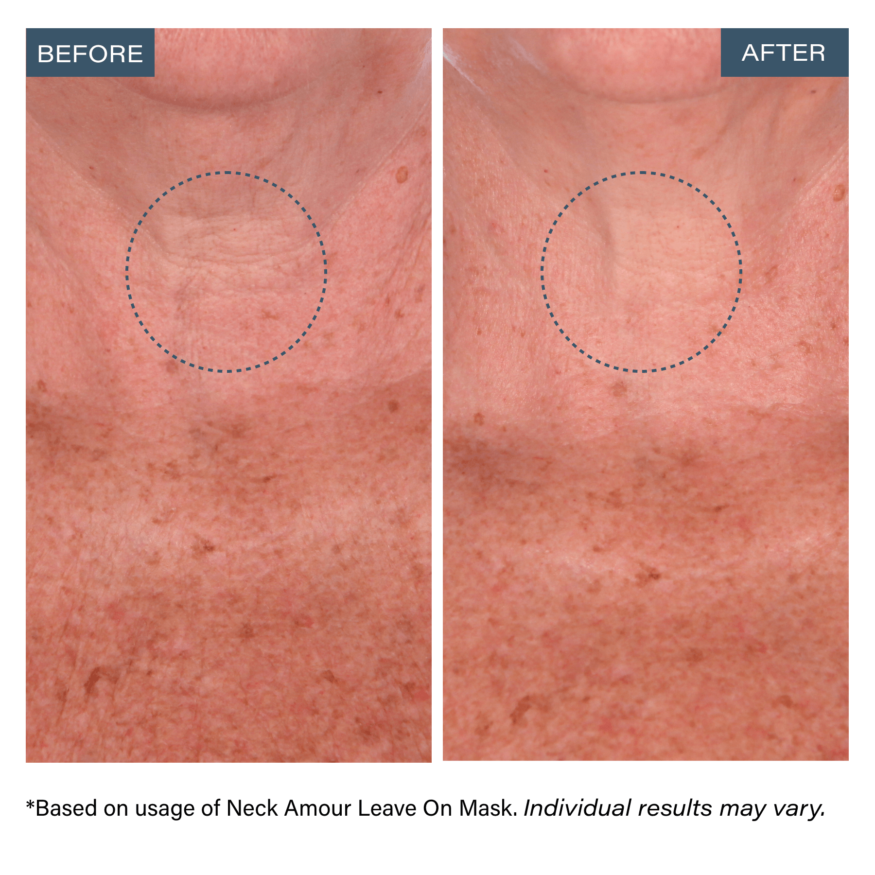 SKINN Skinn Cosmetics: Leave-On Mask with Rice Protein + Probiotics Comfort Body care anti-aging Neck treatment